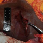 Autopsy of Chinese woman hacked with machete