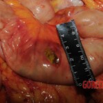 Autopsy of Chinese woman hacked with machete