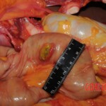 Autopsy of Chinese woman hacked with machete