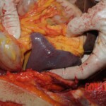 Autopsy of Chinese woman hacked with machete