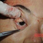 Autopsy of Chinese woman hacked with machete