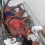 Colombian woman after brutal machete attack by her boyfriend