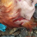 Elderly woman with fatal head injury