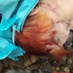 Elderly woman with fatal head injury