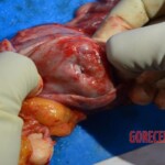 Examination of strangled and raped woman