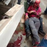 Female factory employee scalped in work accident