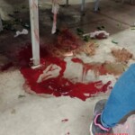 Female factory employee scalped in work accident