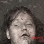 Vintage photo of dead woman