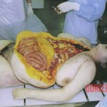 Vintage photo of dead woman