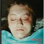 Vintage photo of dead woman