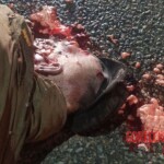 Pedestrian's head gets completely crushed