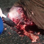 Pedestrian's head gets completely crushed