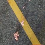 Pedestrian's head gets completely crushed