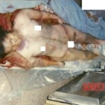 Schizophrenic rapist shared pictures of his dead daughter on internet