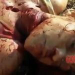 Victim of brutal rape