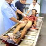 18-year-old thug ended up in morgue