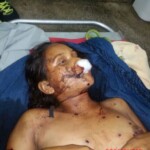 20-year-old woman killed by shotgun blast