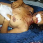 20-year-old woman killed by shotgun blast