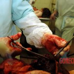 Autopsy photos of woman published in Russian magazine