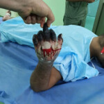 Brutal signs of torture on man detained by Iraqi police