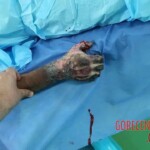 Brutal signs of torture on man detained by Iraqi police