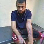 Brutal signs of torture on man detained by Iraqi police