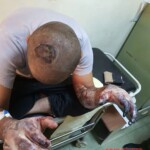 Brutal signs of torture on man detained by Iraqi police