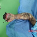 Brutal signs of torture on man detained by Iraqi police