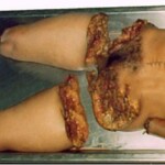 Completely dismembered woman in morgue