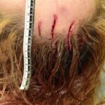 Examination of dead Chinese woman