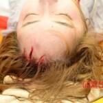 Examination of dead Chinese woman