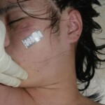 Dead naked Chinese woman