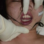 Dead naked Chinese woman