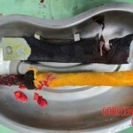 Miracle survival at Dhaka expressway construction site