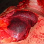 Autopsy of man who died from alcohol poisoning