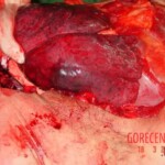 Autopsy of man who died from alcohol poisoning