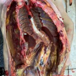 Autopsy photos showing scoliosis