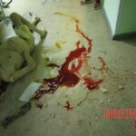 Deranged patient brutally murdered another patient in hospital