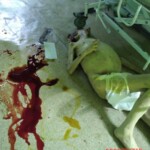 Deranged patient brutally murdered another patient in hospital
