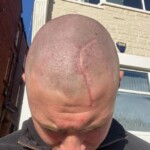 Dude injured his head when he dived into rock