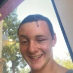 Dude injured his head when he dived into rock