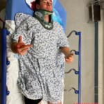 Dude injured his head when he dived into rock