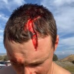 Dude injured his head when he dived into rock