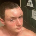 Dude injured his head when he dived into rock