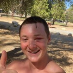 Dude injured his head when he dived into rock