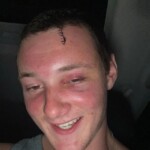 Dude injured his head when he dived into rock