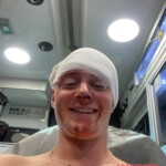 Dude injured his head when he dived into rock