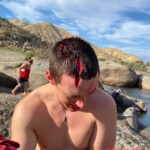 Dude injured his head when he dived into rock