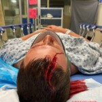 Dude injured his head when he dived into rock