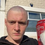 Dude injured his head when he dived into rock